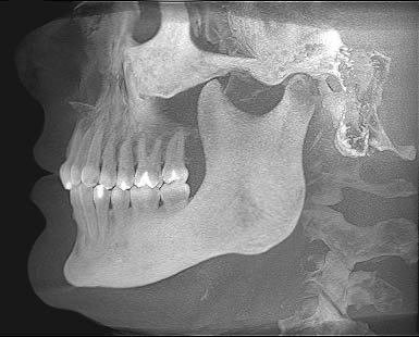 digital dental imaging