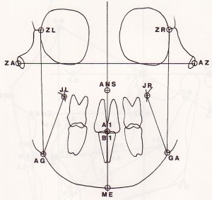 Ricketts Frontal Anatomy 2 Cephalometric Analysis - Ricketts Frontal Anatomy 2